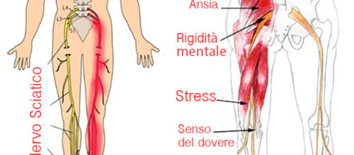 Psicosomatica della sciatalgia: quando le emozioni infiammano il nervo sciatico – Psicoadvisor